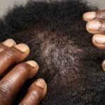 Scalp Nourishment: Why Your Hair Mask Routine Is Failing (And How to Fix It)